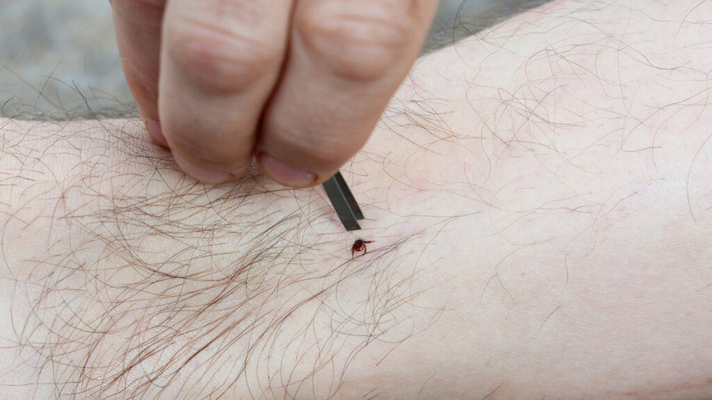 A person attempting to remove a tick off their body after spending time outdoors.