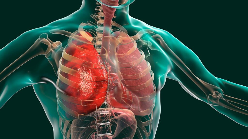 An infographic of the anatomy of human lungs. 